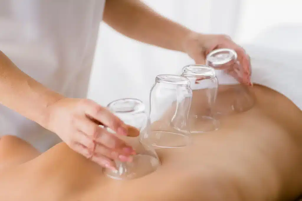 cupping massage